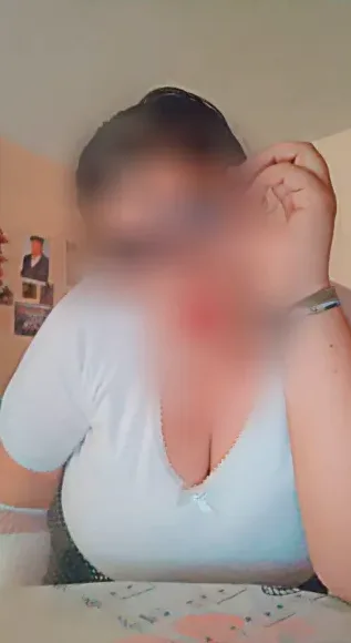 Rosa, 35